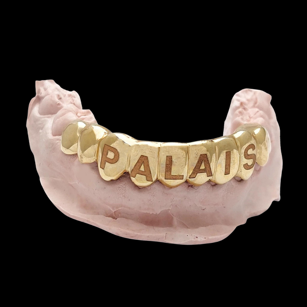 Custom Word/Name Laser Engraving Gold Grillz With Black Rhodium