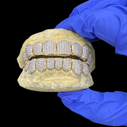 VVS Moisannite 10 on 10 Diamond Grillz