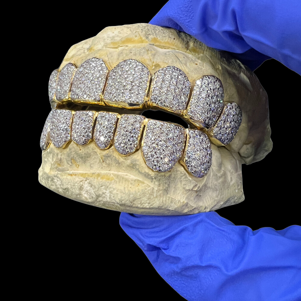 VVS Moisannite 10 on 10 Diamond Grillz