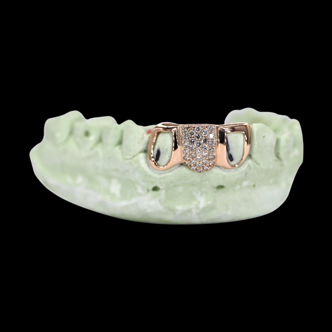 Rose Gold Custom Grillz with Central Pave Diamond & 2 Open Faced Teeth