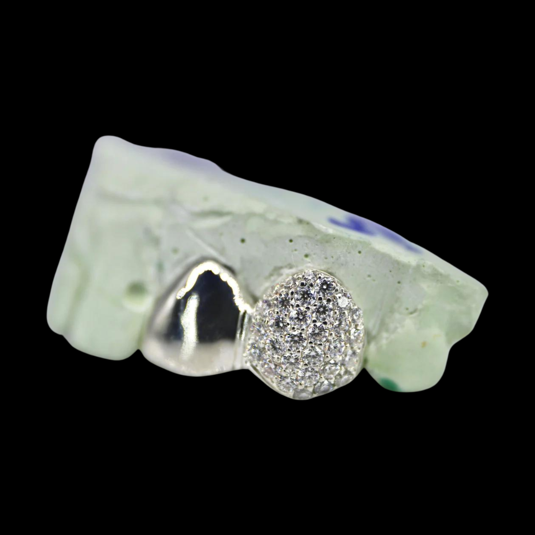 Close-up VVS 2 Teeth Moissanite Diamond Grillz with solid gold end caps and micro-pave stones on dental mold