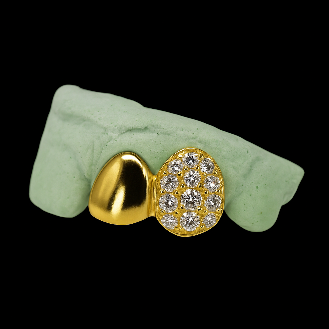 18K Yellow Gold VVS 2 Teeth Moissanite Grillz featuring floral pave pattern and polished solid ends