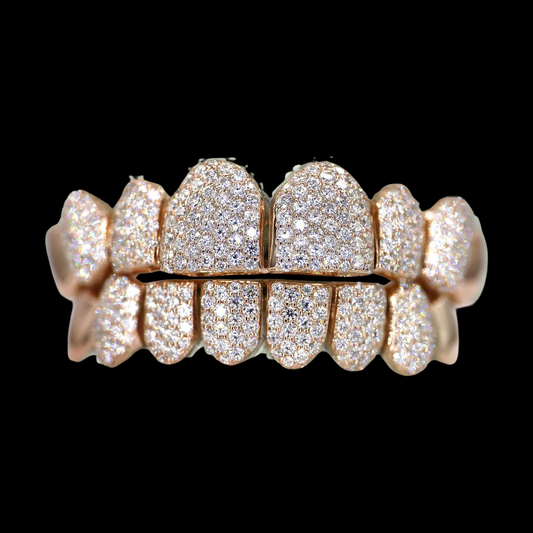 Rose gold full-set capped grillz featuring 20 teeth fully iced out with round VVS moissanites