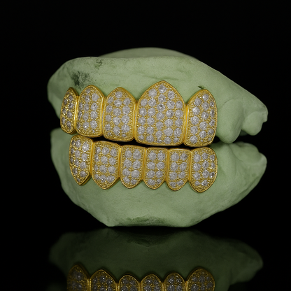 Yellow gold 6-tooth pavé moissanite grillz side angle view