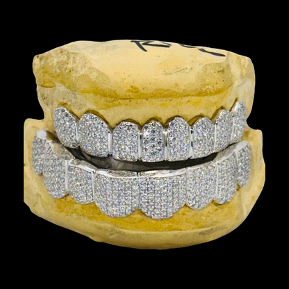 Full-set VVS Moissanite 8-on-8 Diamond Grillz with silver-toned metal edges on dental model