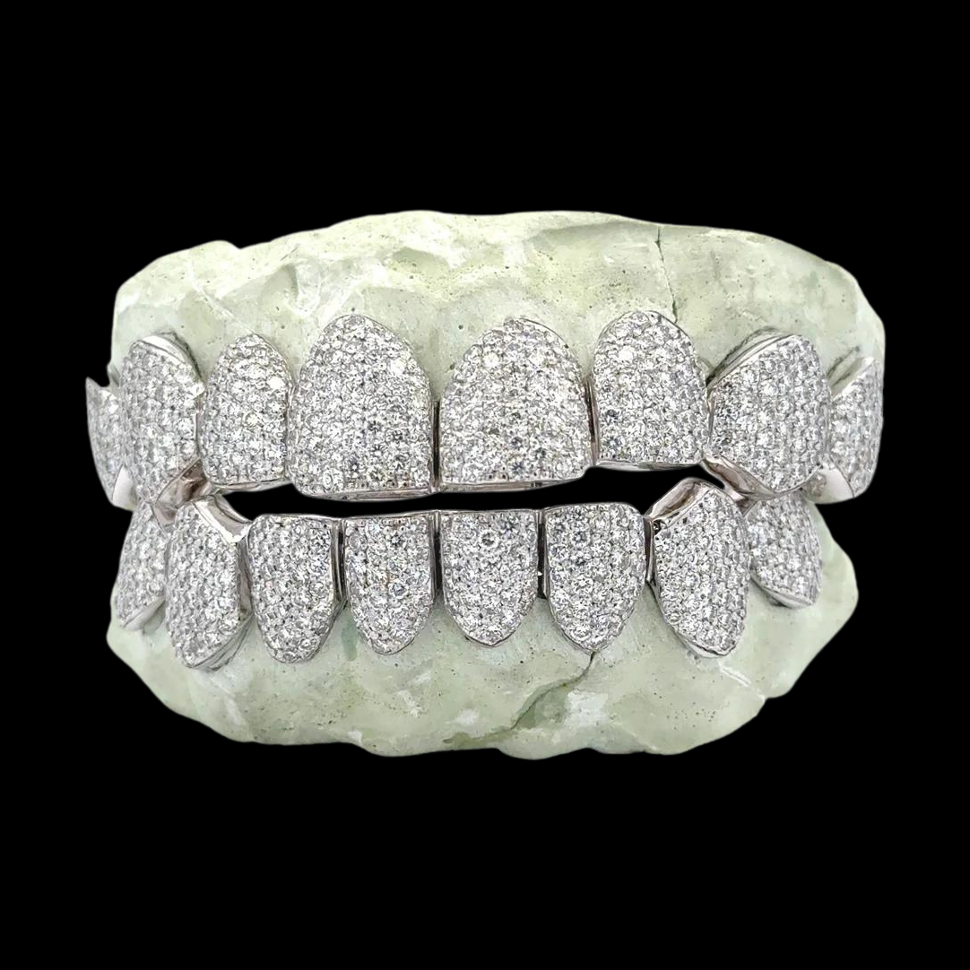 925 Sterling Silver Iced Out Moissanite Grillz Set on Dental Mold