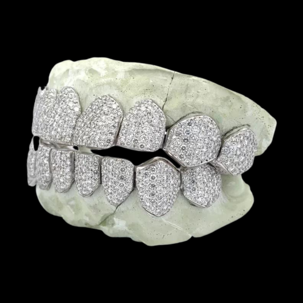 White Gold Custom Fit Micro-Pave Moissanite Grillz Side Profile