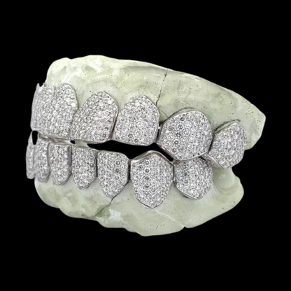 White Gold Custom Fit Micro-Pave Moissanite Grillz Side Profile
