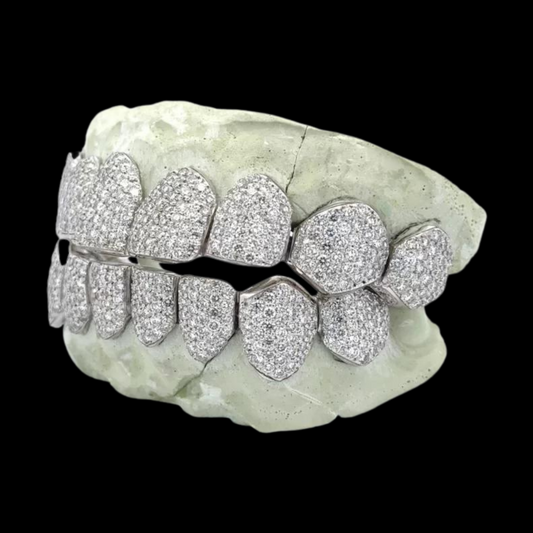 White Gold Custom Fit Micro-Pave Moissanite Grillz Side Profile