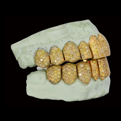 Custom fit yellow canary moissanite grillz on dental mold showing precise tooth shape and seamless gold base
