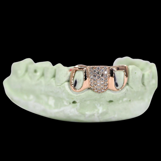 VVS Moissanite 1 Tooth Diamond & 2 Teeth Open Faced Diamond Grillz