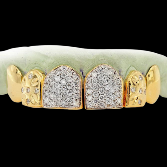 18K HAND PRONG SET 6 TEETH GRILLZ