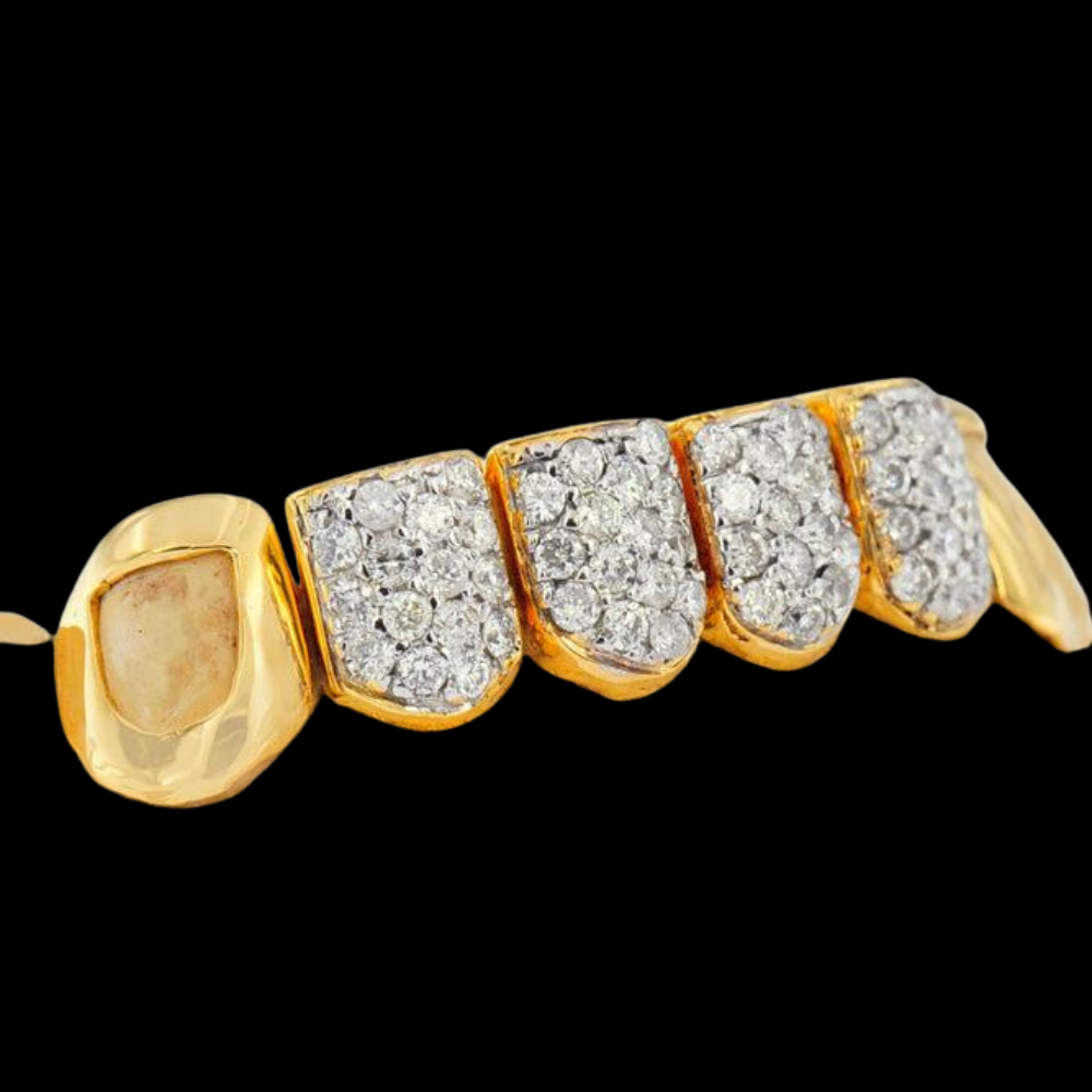 Prong Set Open Face 18k Grillz