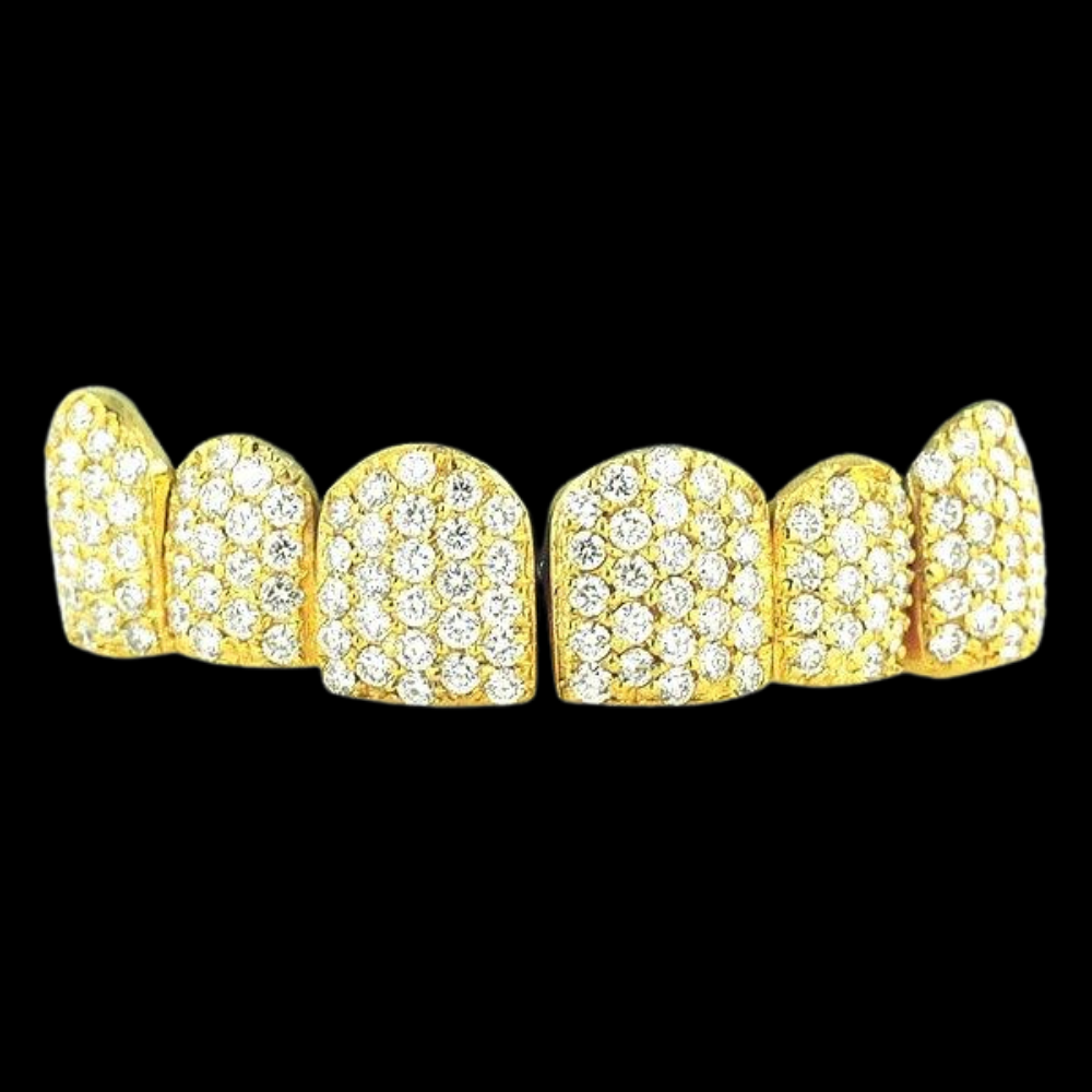 18k Individual Diamond Prong Set Permanent Teeth Grillz