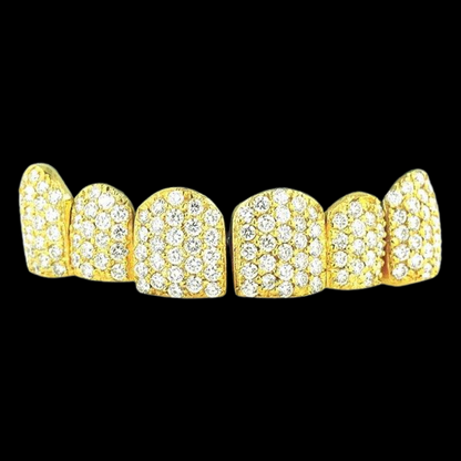 18k Individual Diamond Prong Set Permanent Teeth Grillz