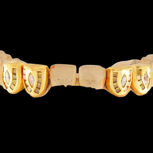 18k Channel Set Diamond Grillz