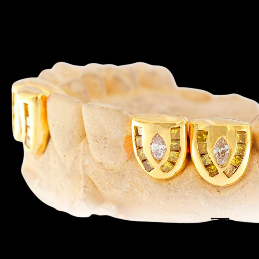 18k Channel Set Diamond Grillz