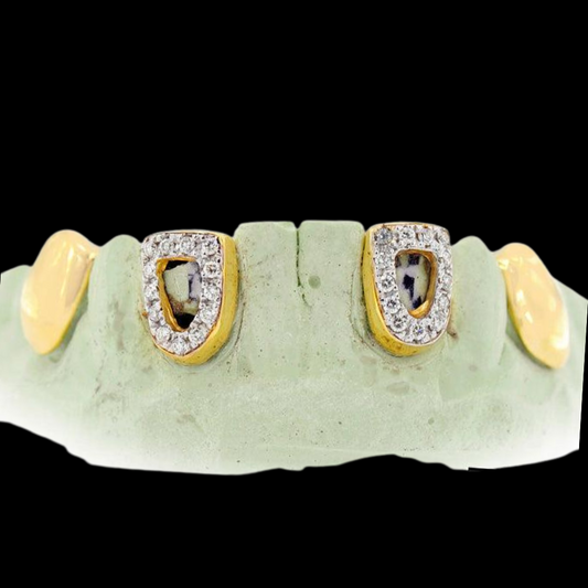 18k Open Face And SI Solid Teeth Grillz