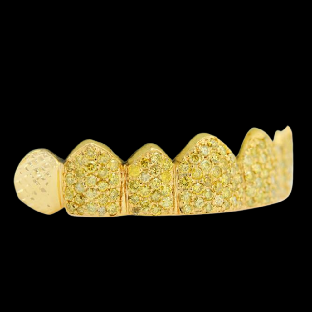 Round Yellow Diamond Grill in Hand Prong Setting