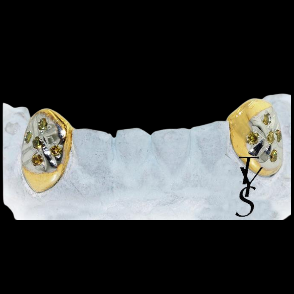 2 Gold Fang Teeth With Diamonds