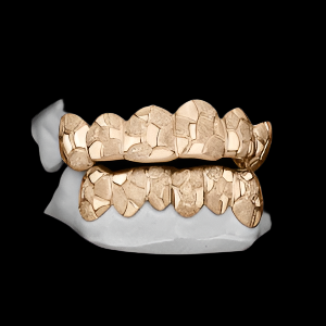 Custom Nugget Style Design Outline Gold Grillz