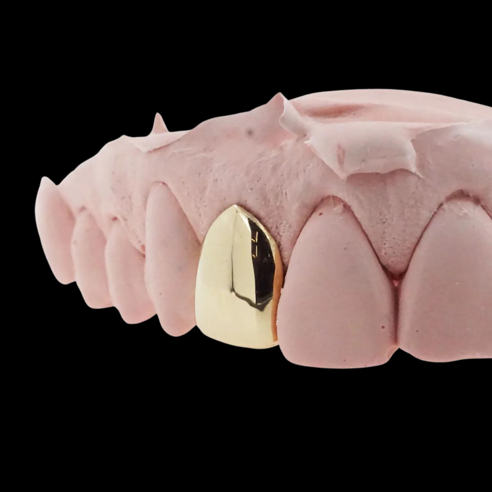 CUSTOM ONE TOOTH (CAP GRILLZ) GOLD GRILLZ