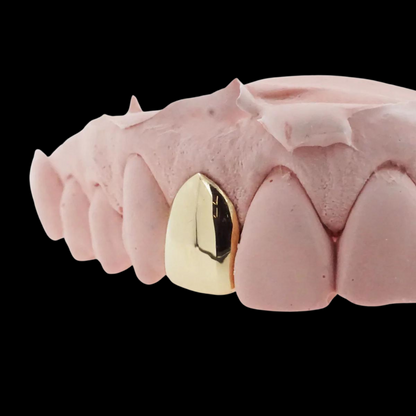 CUSTOM ONE TOOTH (CAP GRILLZ) GOLD GRILLZ.