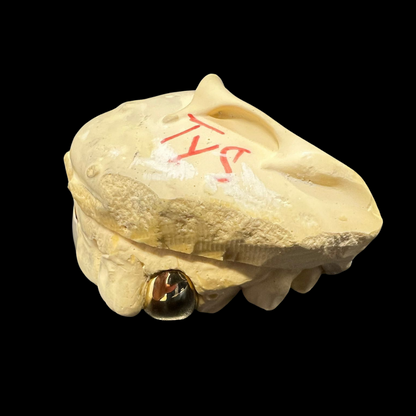 CUSTOM ONE TOOTH (CAP GRILLZ) GOLD GRILLZ.