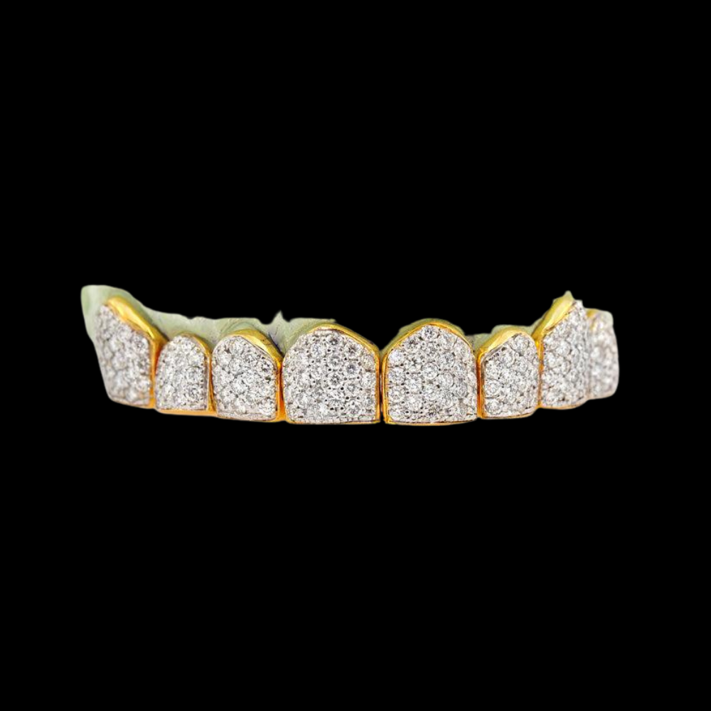 18K Eight Individual Diamond Grillz