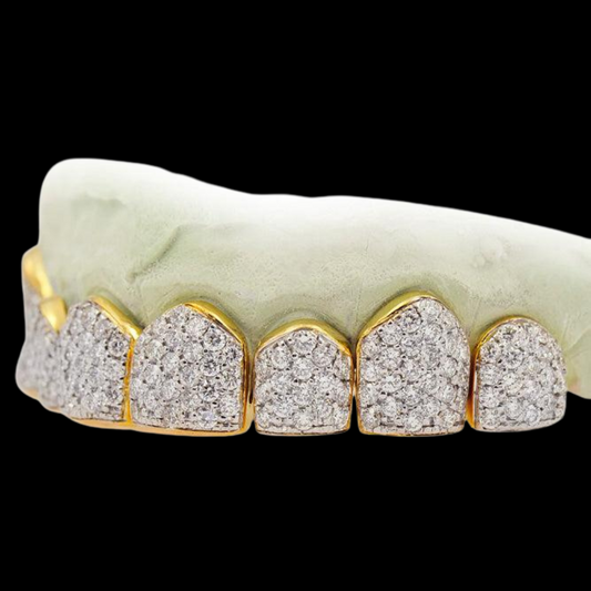 18K Eight Individual Diamond Grillz