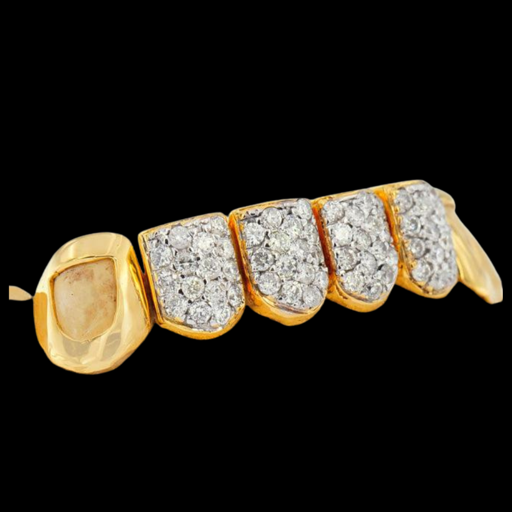 18K Prong Set Open Face Grillz