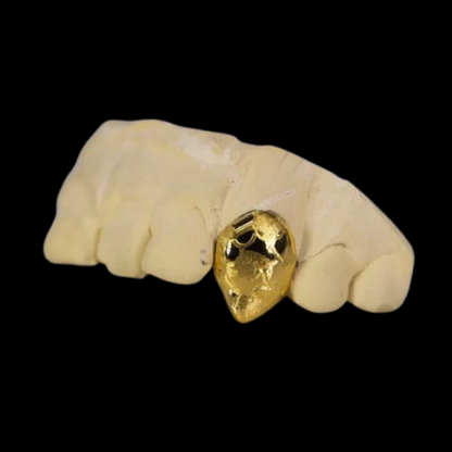 Custom Two-Tone 2 Teeth With Nugget Design Gold Grillz