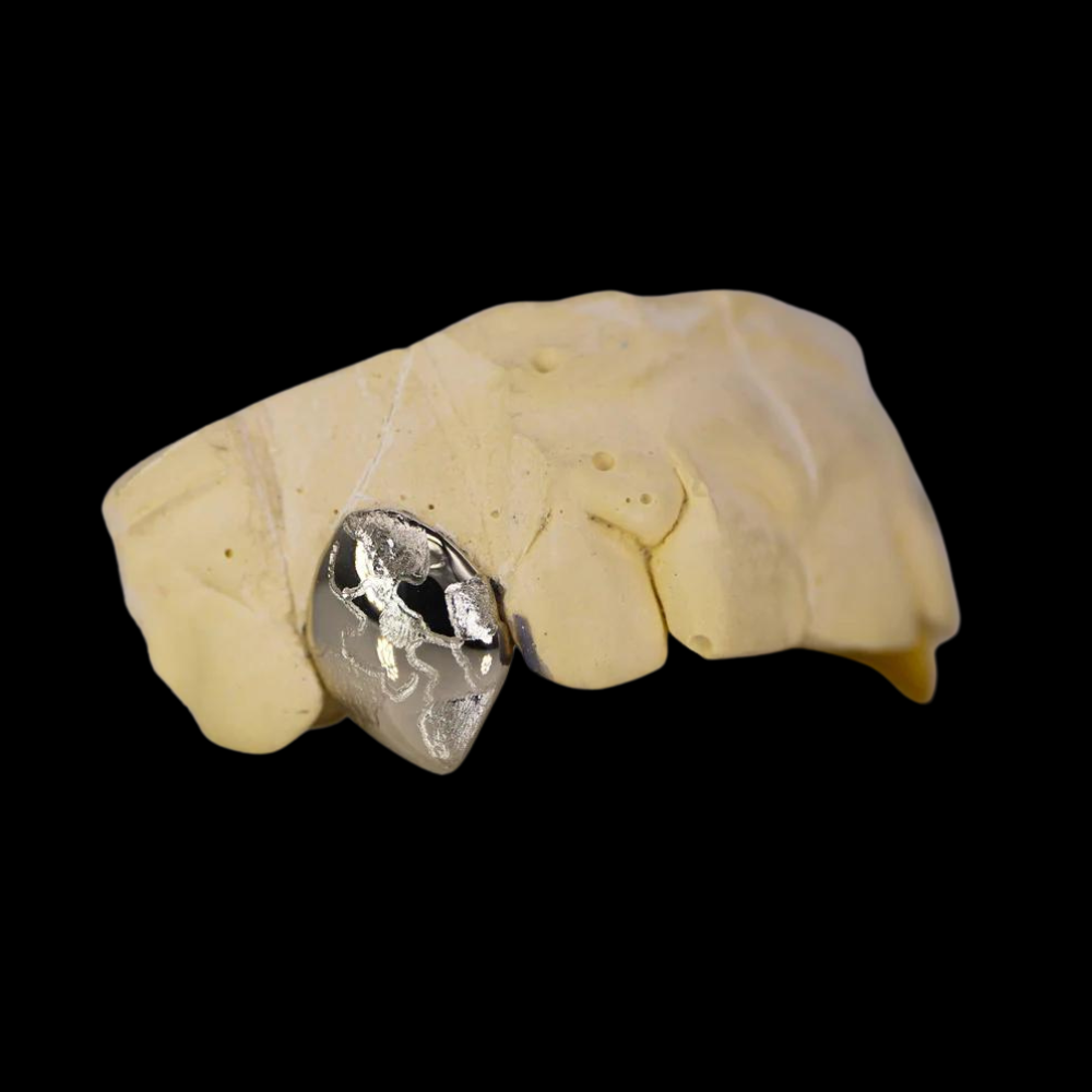 Custom Two-Tone 2 Teeth With Nugget Design Gold Grillz