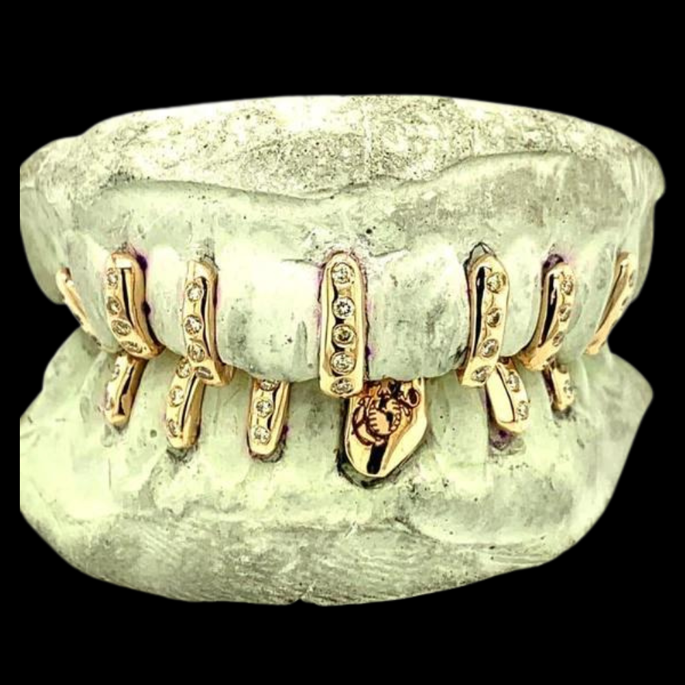 Custom Gap Fillers With Closed Caps Gold (Pharrell Grillz)
