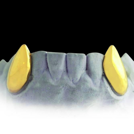 Custom Offical Killmonger From Black Panther Gold Grillz