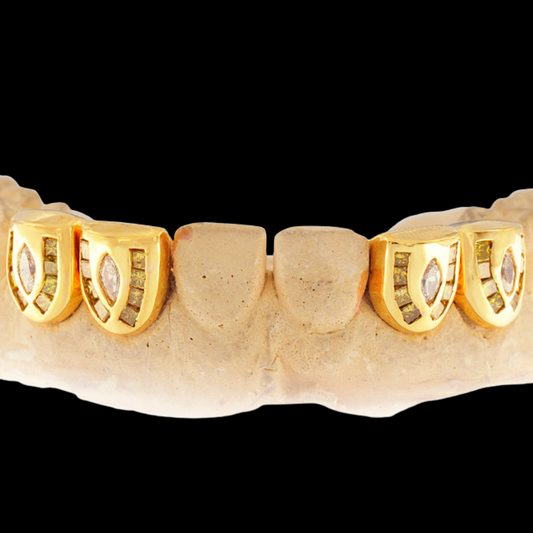 18k Individual Channel Set Diamond Grillz