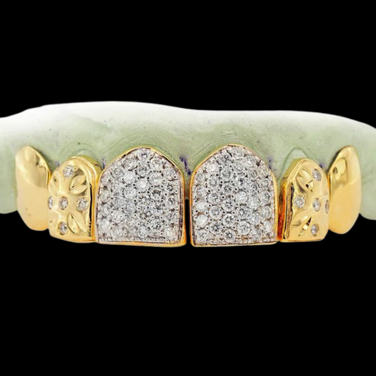 18k Yellow Gold Individual 6 Teeth Grillz