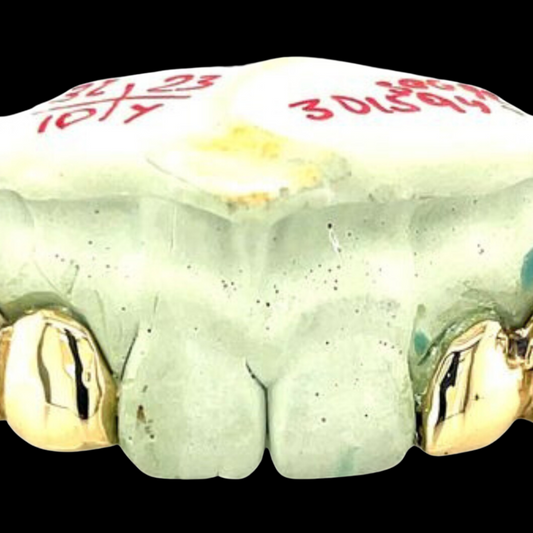 Custom 2 Teeth With 3d Versace Gold Grillz