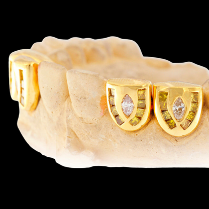 18k Individual Channel Set Diamond Grillz