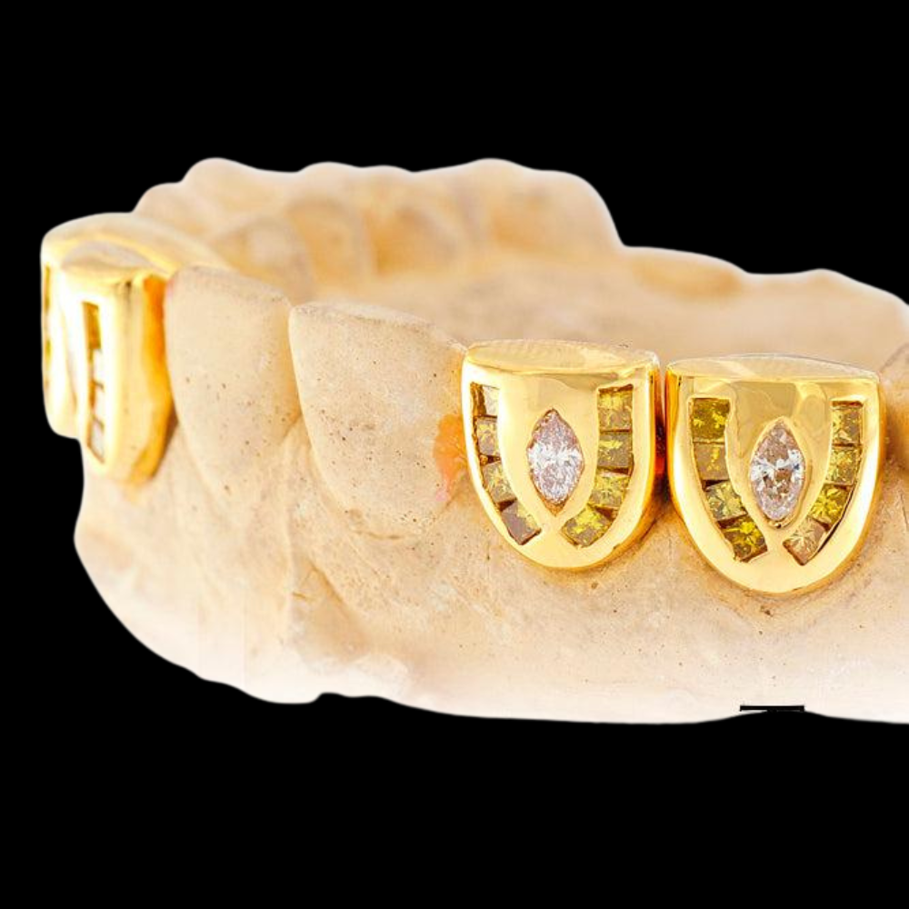 Diamond Individual Channel Set 18K Grillz