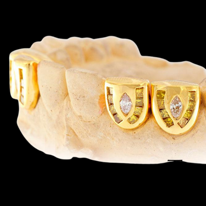 Diamond Individual Channel Set 18K Grillz