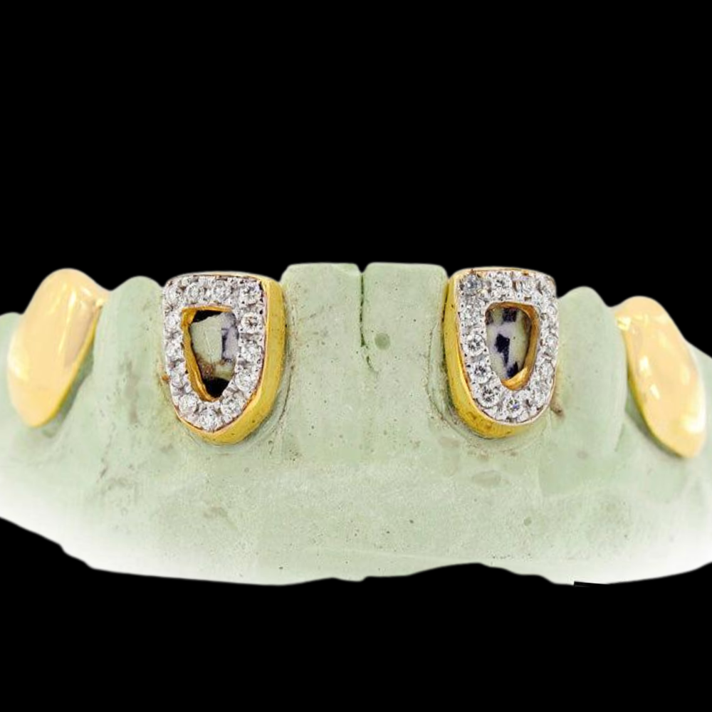 18k Open Face And Solid Teeth Grillz