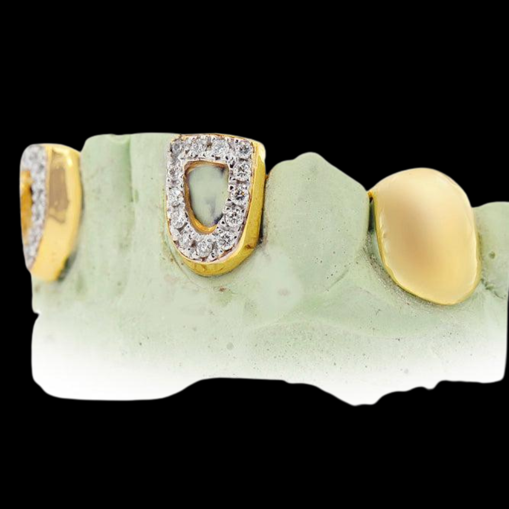 18k Open Face And Solid Teeth Grillz