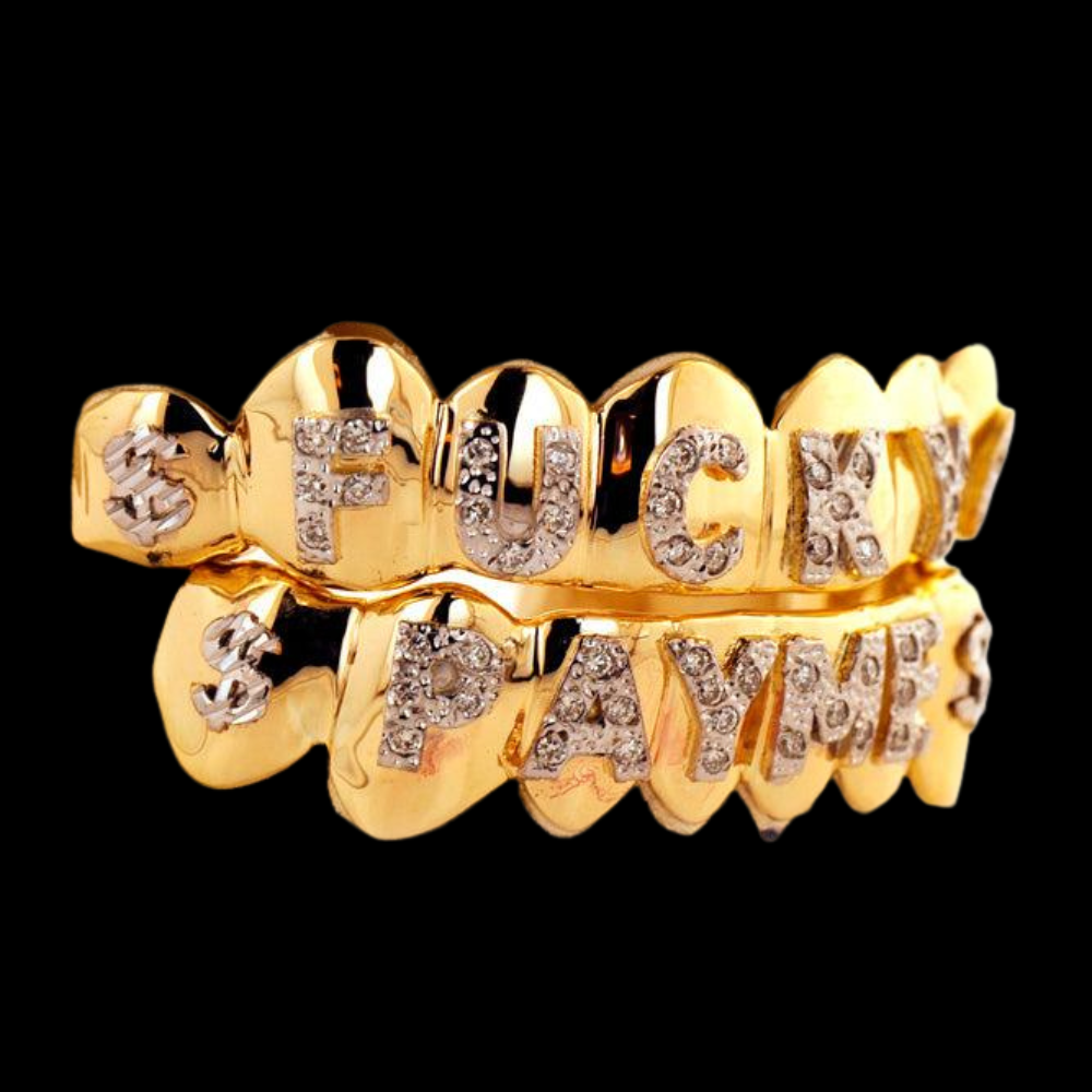 Custom Diamond Pave Set Grillz