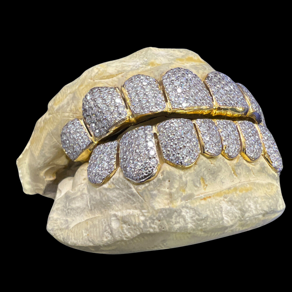 VVS Moisannite 10 on 10 Diamond Grillz