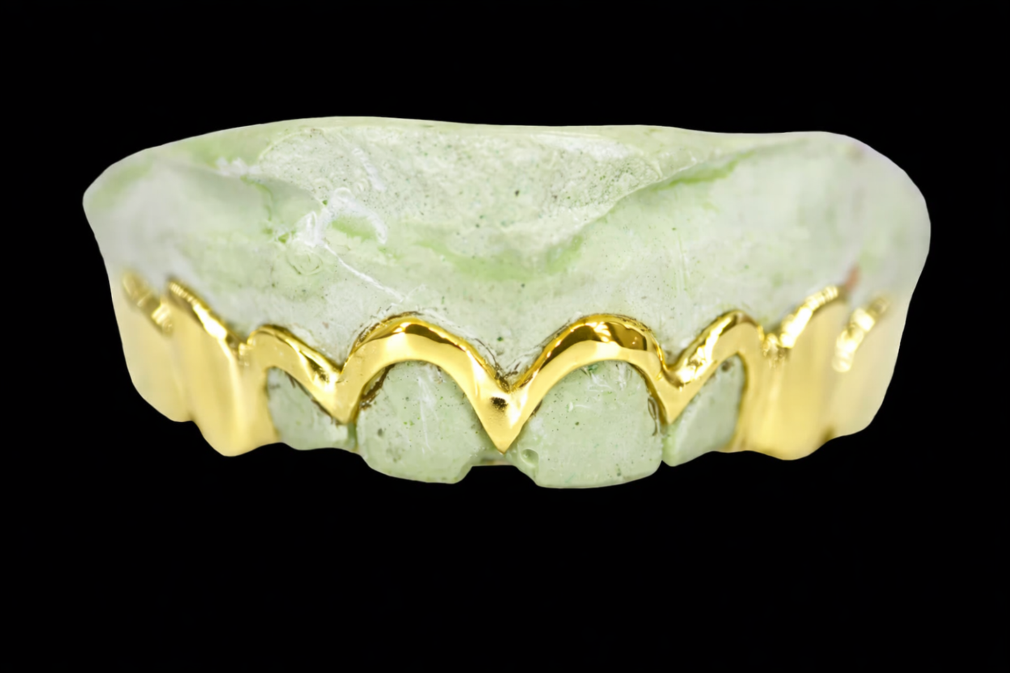 Custom Magneto Gold Grillz