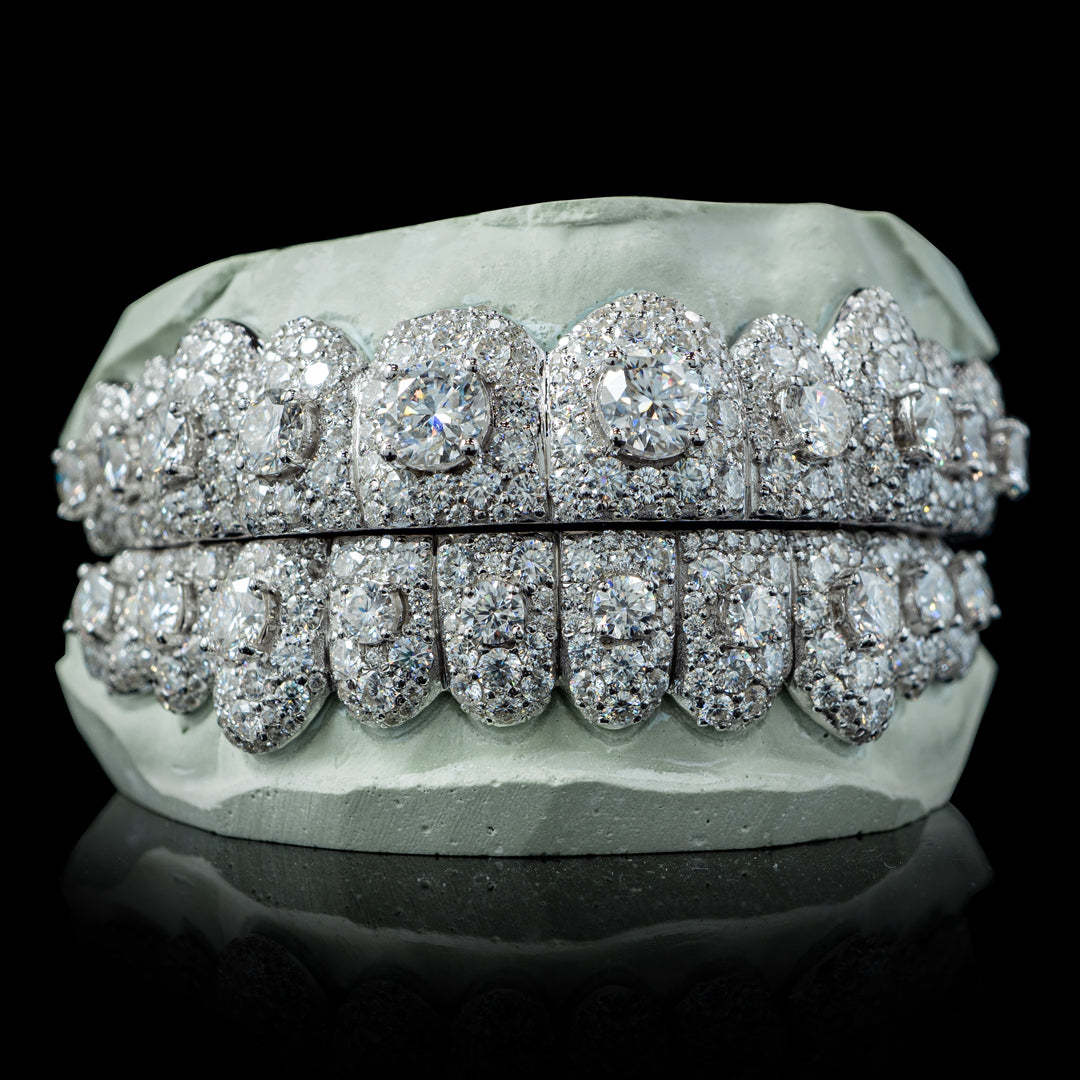 Pointer Stone Center Iced VVS Moissanite Diamond Grillz