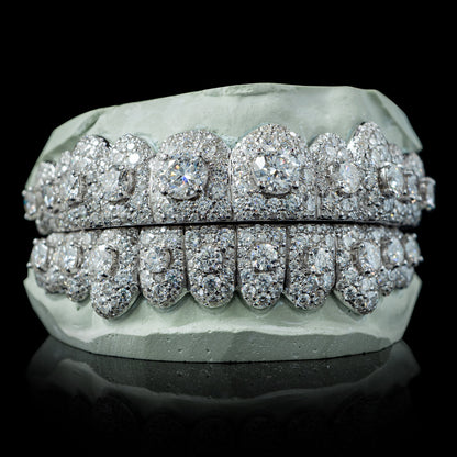 Pointer Stone Center Iced VVS Moissanite Diamond Grillz