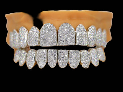 Custom Permanent VVS Moissanite Diamond Grillz