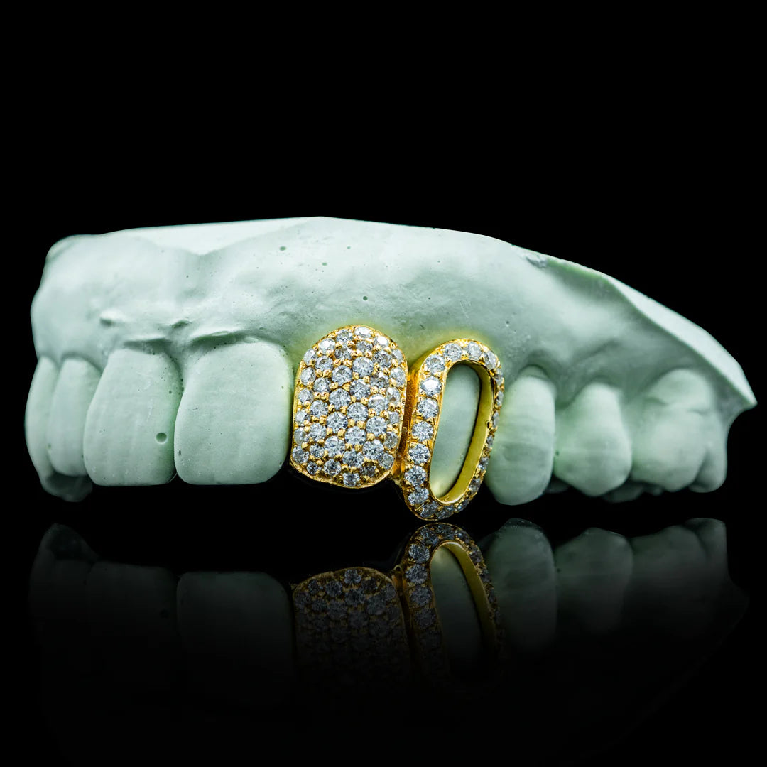 Custom Iced Open Face Double Cap Grillz